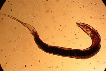 Pinworm