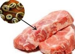 Parasites
