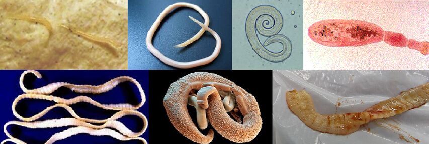 Verschidden Aarte vu Parasiten