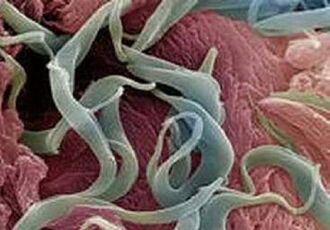 Symptomer a Behandlung vu Parasiten am mënschleche Kierper