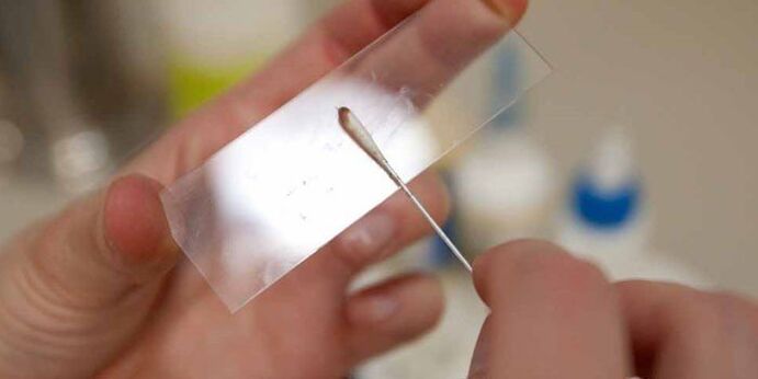 Haut schrauwen fir Parasiten