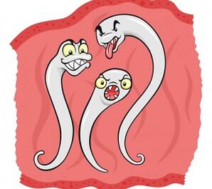 wat Parasiten kënnen am mënschleche Kierper liewen