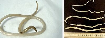 Aarte vu Parasiten am mënschleche Kierper